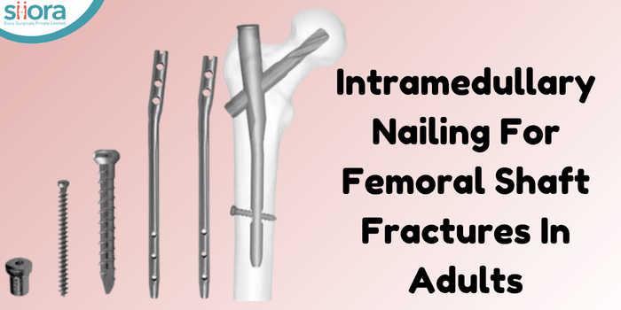 Intramedullary Nailing For Femoral Shaft Fractures