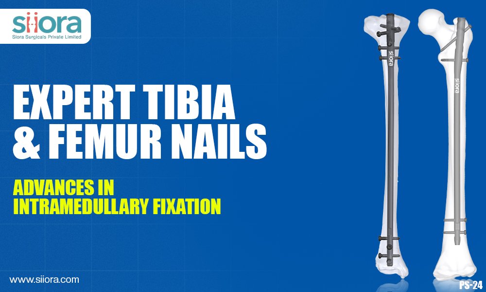 Expert Tibia and Femur Nails: Advances in Intramedullary&nbsp;Fixation